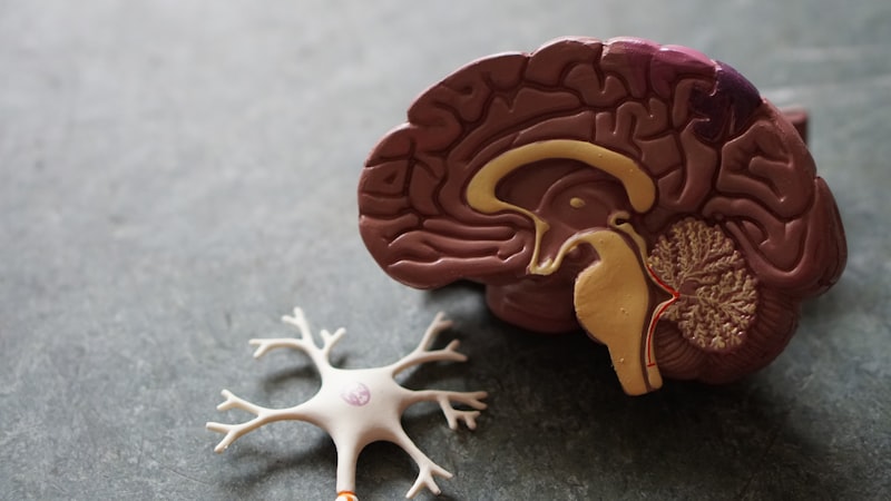 Epilepsia Refractaria